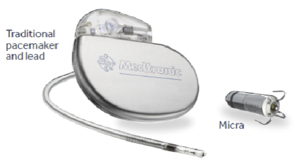 Leadless Implantation Technique